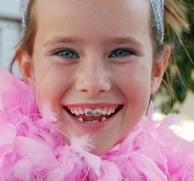 types of braces